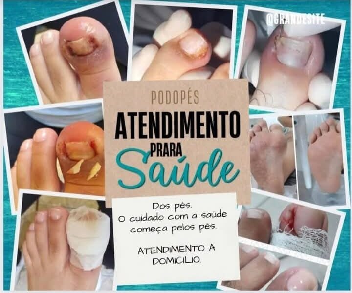 PODO PÉS TOP10