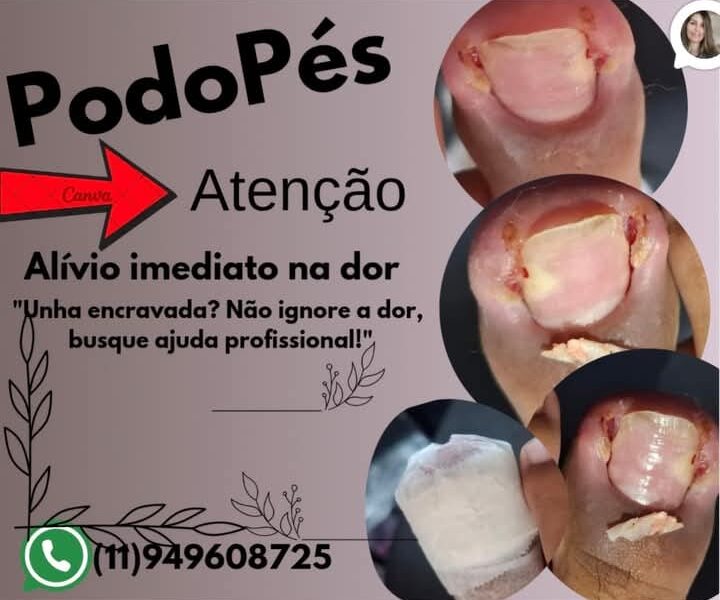 PODO PÉS TOP10